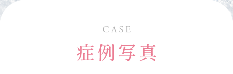 症例写真